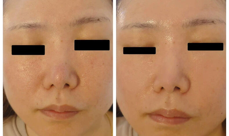 画像3363：🌜